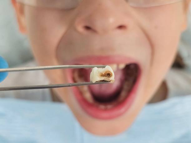Best Urgent Tooth Repair  in Marlborough, MO